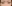 二重まぶた（自然癒着法） — フルルン美容外科クリニック