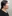 Facelift (rhytidectomy) — DM Plastic Surgery Clinic