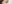 切開法（全切開法二重術） — ルホ美容外科クリニック