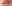 Lip filler (lip augmentation with HA) — Private Beauty Clinic Jiyu