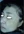 RevLite SI (Q-switched Nd:YAG laser toning) — before (90days) · Look At Me Clinic