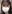 二重まぶた（自然癒着法） — チャイ美容外科