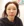 ศัลยกรรมยกริมฝีปากบน (Lip Lift) — หลังทำ (7วัน) · คลินิกความงามมิอินโด-สาขากังนัม