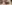 二重まぶた（自然癒着法） — イエロー美容外科クリニック