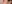 鼻尖形成術（自家軟骨移植） — エイペックス美容外科クリニック