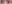 二重まぶた（自然癒着法） — ルホ美容外科クリニック