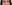 裏ハムラ法（経結膜的眼窩脂肪移動術） — イーエス清潭美容外科クリニック