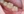 Composite resin filling — after · Yonsei Good Day Dental Clinic - Suseo Branch