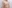 豊胸術（シリコンインプラント／人工乳腺） — ヒューマン美容外科