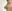 Nasal tip surgery (tipplasty) — Another Plastic Surgery Clinic
