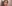 耳たぶヒアルロン酸注入（福耳形成） — ロリポップ美容外科クリニック
