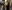 Full-face fat grafting (autologous fat transfer) — Mind Plastic Surgery