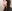 鼻尖形成術（自家軟骨移植） — ジェスタ美容外科クリニック