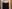 二の腕の脂肪吸引 — ドクターマンゴークリニック