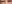 裏ハムラ法（経結膜的眼窩脂肪移動術） — アンド美容外科クリニック