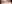 裏ハムラ法（経結膜的眼窩脂肪移動術） — アンド美容外科クリニック