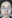 Marionette line filler — Skyline Clinic