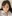 二重まぶた（自然癒着法） — アウラ美容外科クリニック