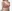 豊胸術（シリコンインプラント／人工乳腺） — SM美容外科クリニック