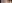 二重まぶた（自然癒着法） — フルルン美容外科クリニック
