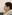 Soprano Titanium laser lifting (Alma trio-wavelength diode laser skin tightening) — Beauty & Young Clinic