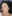 Pico Toning (picosecond laser toning) — Le Shine Clinic