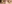 裏ハムラ法（経結膜的眼窩脂肪移動術） — プレジャー美容外科クリニック