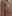 乳房挙上術（バストリフト）＋豊胸術 — バナナ美容外科クリニック