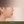 ศัลยกรรมยกริมฝีปากบน (Lip Lift) — หลังทำ (7วัน) · คลินิกเสริมความงามคลีฟ