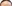 額縮小術（生え際下げ・ヘアライン下降術） — 風が吹く日にも美容外科クリニック