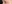 眼瞼下垂手術（目つき矯正） — ハッシュ美容外科クリニック