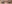 涙袋ヒアルロン酸注入（涙袋形成） — セイエスクリニック