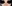 Crooked (deviated) nose rhinoplasty — Coco Line Clinic