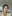 Nasal Tip Plasty with Autologous Cartilage — Tianna Plastic Surgery Clinic