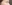 二重まぶた（自然癒着法） — ルホ美容外科クリニック