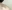 僧帽筋ボトックス（肩ボトックス） — ムイ美容外科クリニック