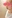 隆鼻術（シリコンプロテーゼ） — アーバン美容外科クリニック