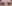 二重まぶた（自然癒着法） — フルルン美容外科クリニック