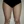Full-body liposuction — before (21days) · Aurora Clinic