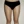 Full-body liposuction — after (21days) · Aurora Clinic