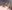 眼瞼下垂手術（目つき矯正） — アウラ美容外科クリニック