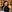 Full-face fat grafting (autologous fat transfer) — Mind Plastic Surgery