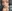Nasal tip surgery (tipplasty) — Haibom Plastic Surgery Clinic