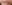 唇のヒアルロン酸注入（リップヒアルロン酸） — ロリポップ美容外科クリニック