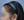 Scalp hair transplant — after (7days) · Do Jagi Clinic