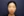 耳垂整形（丰耳垂/耳垂修复） — 术前 · Ideal整形外科