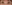 眼瞼下垂手術（目つき矯正） — エイペックス美容外科クリニック