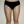 Full-body liposuction — after (21days) · Aurora Clinic