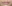 人中短縮（リップリフト） — ドクタータク美容外科クリニック
