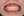 Clippy-C self-ligating ceramic braces (TOMY) — after (420days) · Song Byungjae Orthodontic Clinic